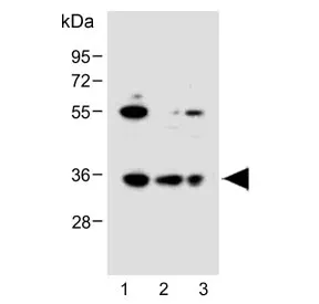 BCKDHB Antibody - image 1