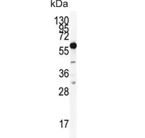 HDAC2 Antibody - image 1