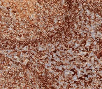 HLA-DPB1 Antibody (MHC II) - image 1
