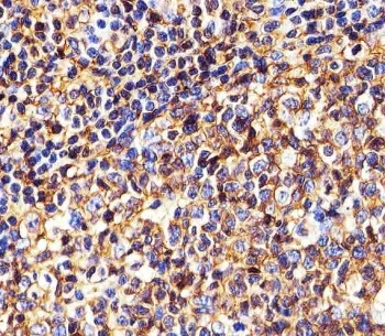 HLA-B Antibody (MHC Class I) - image 1