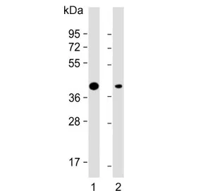 Adiponectin Receptor 2 Antibody / ADIPOR2 - image 1