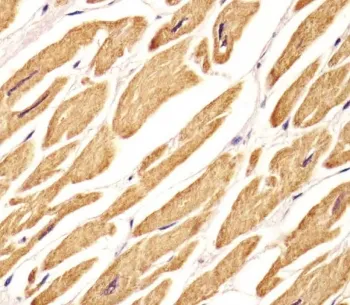 VLDLR Antibody / VLDL Receptor - image 1