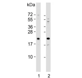 GLO1 Antibody / Glyoxalase I - image 1