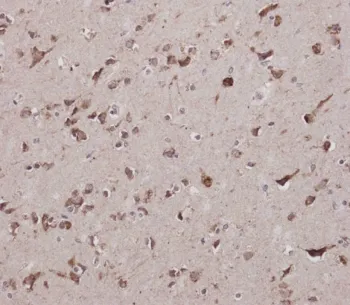 CBS Antibody / Cystathionine Beta Synthase - image 1