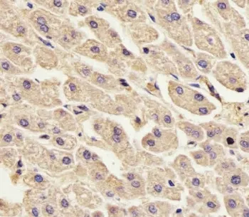 Annexin A2 Antibody / ANXA2 - image 1
