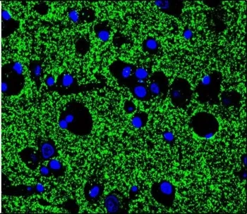 Synaptophysin Antibody - image 1