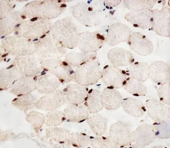 PPAR alpha Antibody / PPARA - image 1