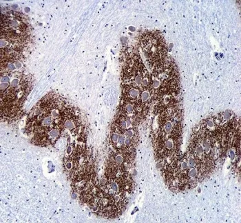 Synaptophysin Antibody - image 1