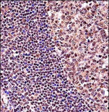 TCF3 Antibody / Transcription factor E2-alpha - image 1