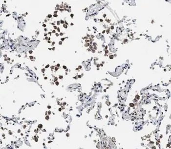 ADAMTS17 Antibody - image 1