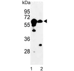 CBS Antibody / Cystathionine Beta Synthase - image 1