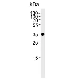 IFNGR2 Antibody / IFN gamma Receptor beta - image 1