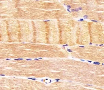 CDK5 Antibody - image 1