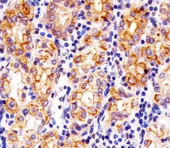 SLC22A2 Antibody / OCT2 - image 1