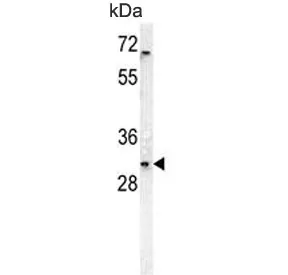 DcR3 Antibody / TNFRSF6B - image 1