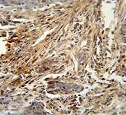 Granulocyte-Macrophage CSF Antibody / CSF2 - image 1