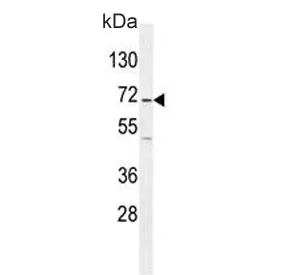 GAD65 Antibody / GAD2 - image 1
