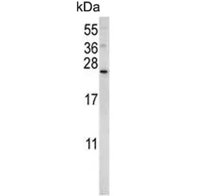 Sorting nexin-24 Antibody / SNX24 - image 1