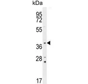 Twinfilin 2 Antibody / TWF2 / PTK9L - image 1