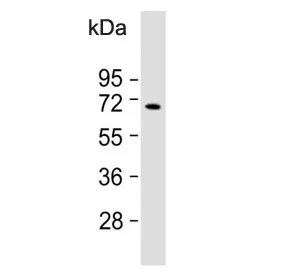 Bradykinin Antibody / Kininogen - image 1