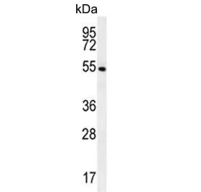 Glutathione Reductase Antibody / GSR - image 1