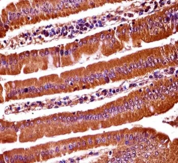 OXSR1 Antibody - image 1