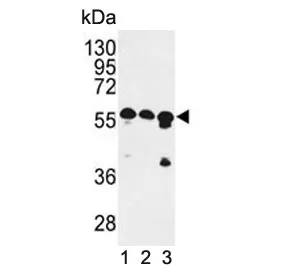 CCR4-NOT transcription complex subunit 4 Antibody / CNOT4 - image 1