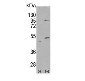 ALDH5A1 Antibody - image 1
