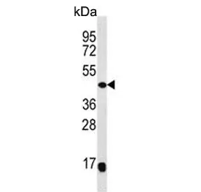 MEK4 Antibody / MKK4 / MAP2K4 - image 1