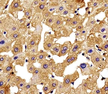 Hemoglobin subunit gamma-2 Antibody / HBG2 - image 1