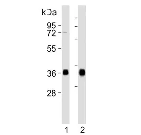 HLA-DQA1 Antibody - image 1