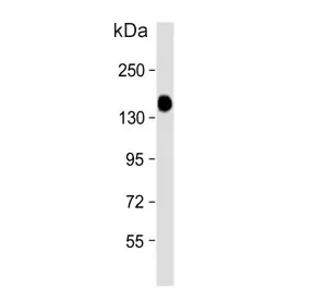 Glycogen debranching enzyme Antibody / AGL - image 1