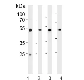 Alpha Enolase Antibody / ENOA - image 1