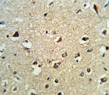 ARHGDIA Antibody / RHOGDI Antibody - image 1