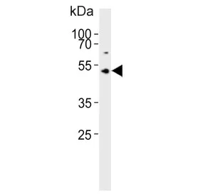 ASMT Antibody / Acetylserotonin O-methyltransferase - image 1