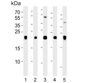 Inosine triphosphate pyrophosphatase Antibody / ITPA / ITPase - image 1