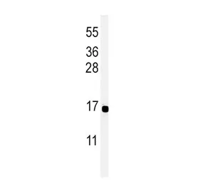Peptide YY Antibody / PYY - image 1