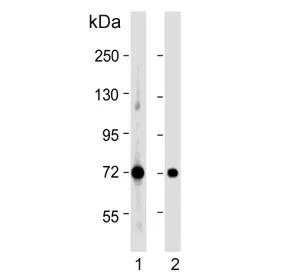 Pyruvate Dehydrogenase E2 Antibody / DLAT - image 1