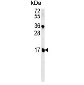 BLOC1S2 Antibody / BLOC-1 subunit 2 - image 1