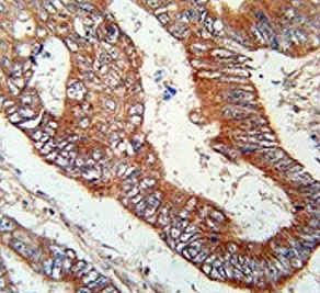Kelch-like protein 6 Antibody / KLHL6 - image 1