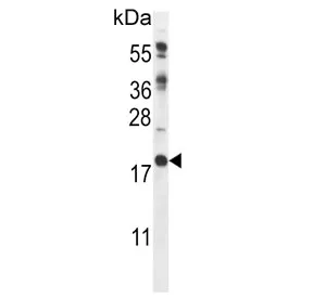 Calcipressin-2 Antibody / RCAN2 / DSCR1L1 - image 1