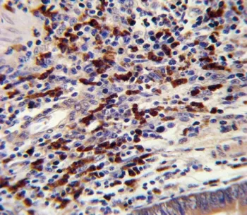 CNOT8 Antibody / CCR4-NOT transcription complex subunit 8 - image 1