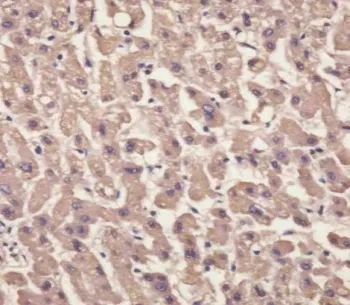 Transthyretin Antibody / TTR / Prealbumin - image 1