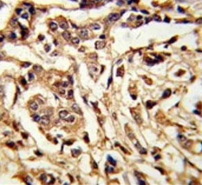 Galactose-1-phosphate uridylyltransferase Antibody / GALT - image 1