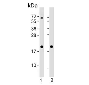 Ferritin heavy chain Antibody / FTH1 - image 1
