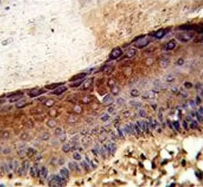 UDP-glucose 4-epimerase Antibody / GALE - image 1