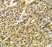 KCNJ2 Antibody / Inward rectifier potassium channel 2 - image 1