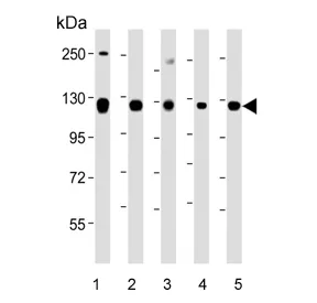 ROR2 Antibody - image 1