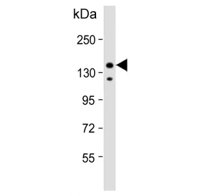 IRS2 Antibody / Insulin receptor substrate 2 - image 1