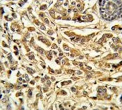 CYP21A2 Antibody / Steroid 21-hydroxylase - image 1